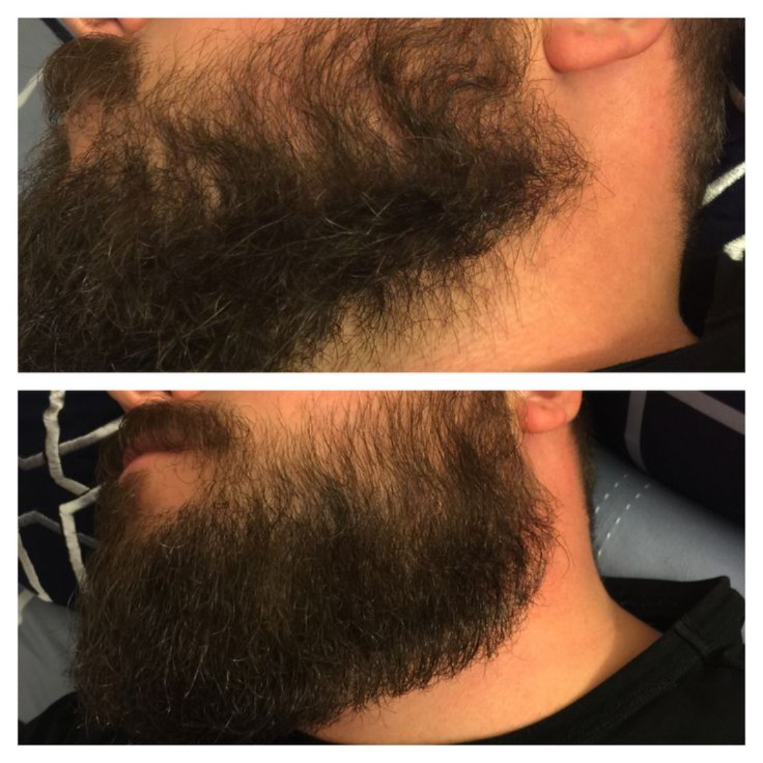 Dr. Alies Professional Beard Growth Oil
